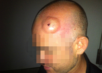 Dos policías locales de Peñíscola acaban en el hospital a causa de agresiones por parte de manteros esta madrugada